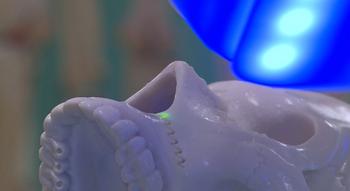 Swiss Startup - Advanced Osteotomy Tools - AOT Additional Image
