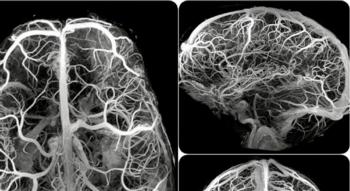 Swiss Startup - Artiria Medical Additional Image