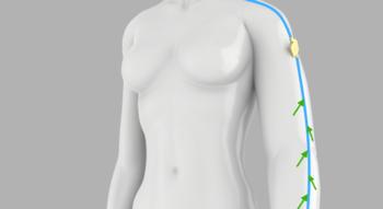 Swiss Startup - Lymphatica Medtech Additional Image