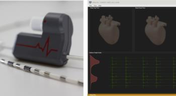 Swiss Startup - Augury Medical Product Image