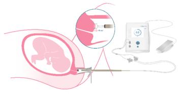 Swiss Startup - Pregnolia Product Image