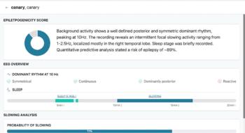 Swiss Startup - dEEGtal Insight Product Image